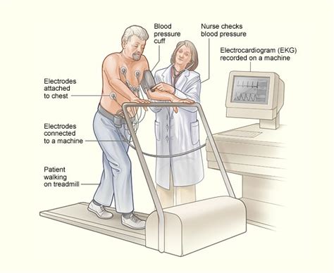 Exercise Stress Echocardiogram .